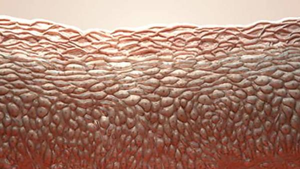 5 Important Signs that Melanoma Has Spread