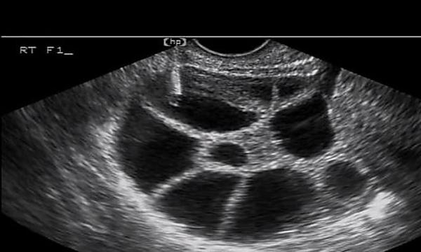 [Pics] When This Pregnant Woman Saw The Ultrasound Pic, Her Jaw Hit The Floor